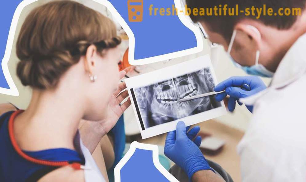 4 otázky o zubních implantátů