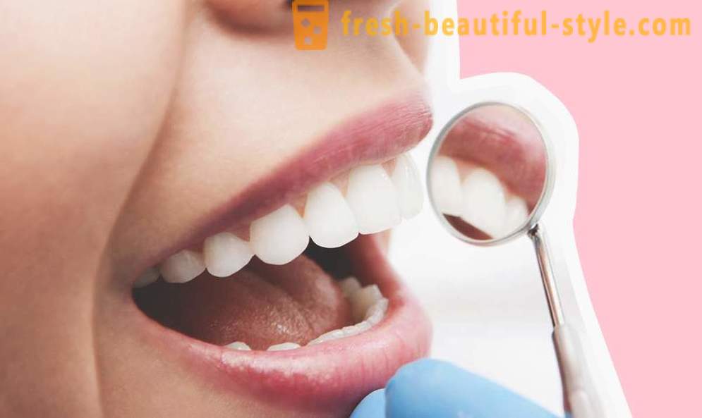4 otázky o zubních implantátů