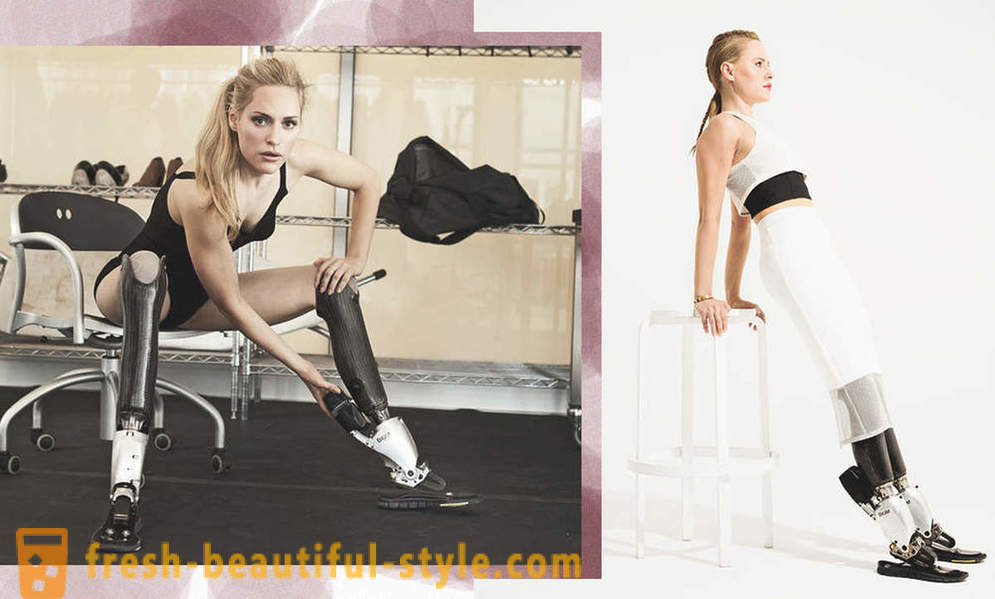 Nekonečná krása: 6 ženské modely s protézy