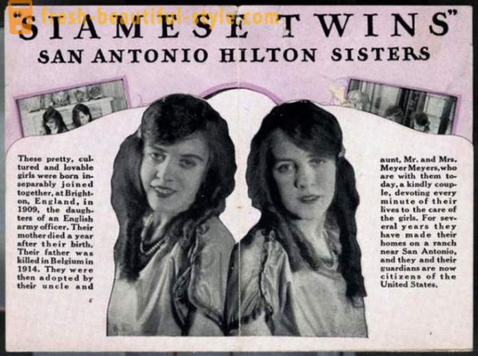 „Nicméně, až do smrti.“ Ciamskie Hilton dvojčata a jejich historie