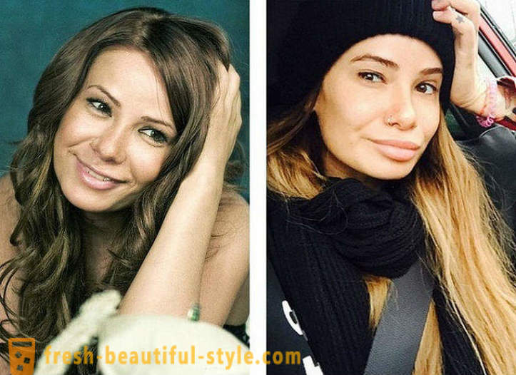 10 ruských krásy před a po plastu