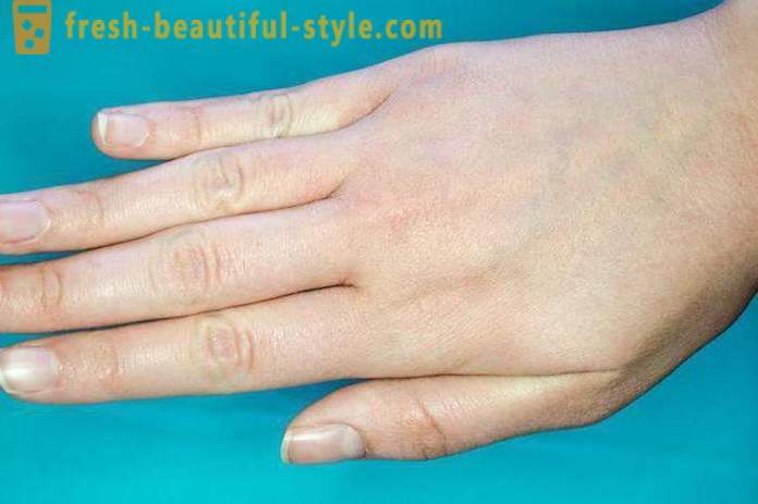 Šupinatá kůže na obličeji a rukou: Možné příčiny a charakteristiky péče