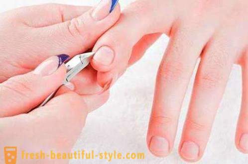 Jak se zbavit otřepů na prstech? Příčiny a ošetření